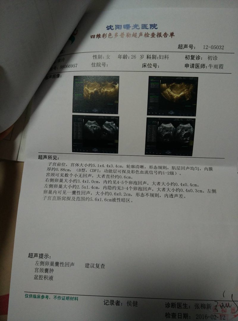 沈阳卵巢囊肿